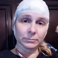 Fundraiser by Caleb Kruse : Brain injury survivor facing brain surgery....