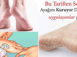 Yuzunuzdeki Veya Vucuttaki Kirmizi Lekelerin Sebebi Nedir Ne Iyi Gelir 2021 Akupunktur Evde Hazirlabilen Ilaclar Ev Yapimi Cilt Bakimi