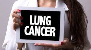 Lawrence shulman, do, chief of the division of pulmonary and sleep medicine at prohealth care, says that if you've received a recurring diagnosis of pneumonia in the same area of the lung, it could be a sign of lung cancer. Lung Cancer Eight Signs You Need To Know Lifestyle News The Indian Express