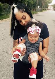 Little Girl Born With A White Patch Of Hair Which Is Exactly The Same As Her Mum S White Streak In Hair Family Photo Outfits Winter Beautiful Babies
