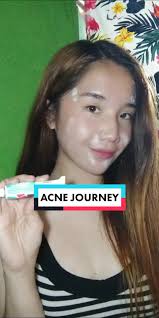 Legit na achieve ang clearskin sa @Dr.S.Wong Bioderm Ointment ✨ Do u want  to achieve a much clearer skin? Check them out now