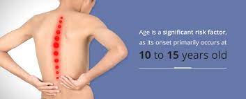 Find out the answers to 6 common questions about spinal scoloiosis including whether a sufferer shoul. Scoliosis Everything To Know Orthobethesda