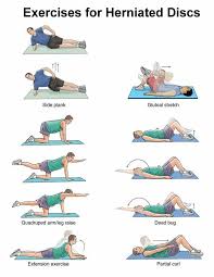 Discus Hernia Exercises Herniated Disc Herniated Disc Exercise Hernia Exercises