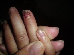 Hey ich habe mir vor 2 wochen kunstnägel aufgeklebt jedoch ist der erste heute abgefallen. Modellage Ab Welchem Alter Kunden Marketing Werbung