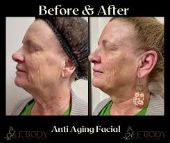 Le' Body Med Spa-Austin, Manor, Pflugerville