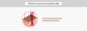 Nair, like other chemical depilatory creams, dissolves the disulphide bonds between keratin proteins in the hair shaft 4. How Does Laser Hair Removal Work On Dark Skin Urbana