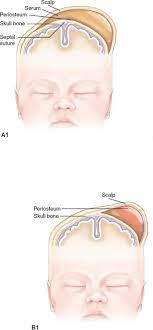Nuas240t Chapter 18 Nursing Management Of The Newborn Diagram Quizlet