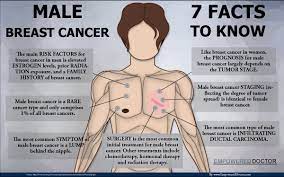Redness or flaky skin in the breast. The Truth About Male Breast Cancer