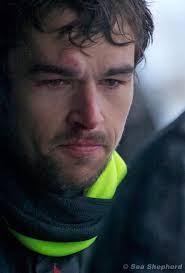 Reatta 3yr M whom fell and cut his face @1315