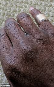 The fish bowl, gold fish bowl , pupfish bowl , and lava serpent bowl are decorative furniture items. Man Shares His Emotional Response To Wearing A Band Aid That Matches His Skin Tone Daily Mail Online