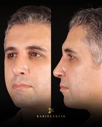 Am 23. Mai bin ich in Salzburg (Österreich)! 🇦🇹 Ich freue mich darauf,  Sie persönlich in der Klinik von Dr. Fatma Gürel zu treffen. Haben Sie  Fragen rund um Plastische Chirurgie? Jetzt