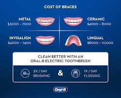 How to get your teeth white while still having braces?! How Much Do Braces Cost Oral B