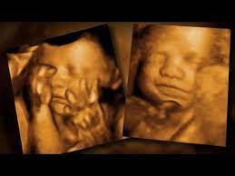 Fda Warns Against 3 D Keepsake Ultrasounds Youtube