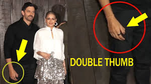 See Hrithik Roshan Sixth Finger Double Thumb Latest Video Youtube Pinkie roshan remembers hrithik's brain surgery on his birthday hrithik roshan, the greek god of bollywood turned 46 today (january 10).