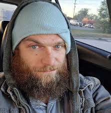 What wireless fence options are available for my dog?