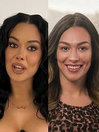 90 Day Fiance star's nose job improvement