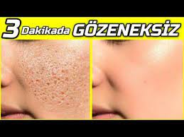 3 Dakikada Gozenek Yok Eden Maske Kusursuz Puruzsuz Cilt Icin Mukemmel Yontem Guzellik Bakim Youtube 2020 Mukemmel Makyaj Maskeler Guzellik