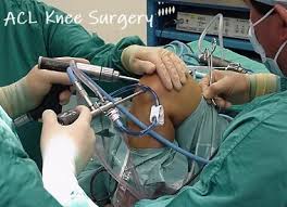 Acl Reconstruction Surgery Knee Pain Explained