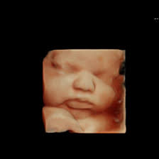Mandy Lilly 3D/4D Ultrasound