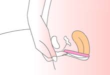 Saalt's fully sustainable period care will break you and your wallet free of the tampon aisle—forever. Menstrual Cup Wikipedia