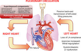 Heart Failure European Heart Journal Oxford Academic