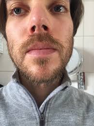 29 years, first attempt growing a full beard, Update: 10 weeks