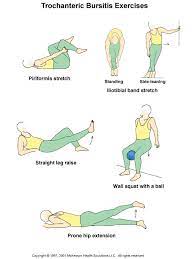 Trochanteric Bursitis Exercises Hip Bursitis Treatment Bursitis Hip Bursitis Treatment