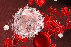 September 22, 2020 10:50:17 am. Blood Cancer Awareness Month Highlighting Our Open Access Blood Cancer Research On Medicine