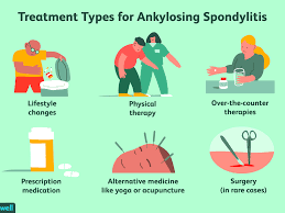 how ankylosing spondylitis is treated