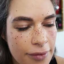 Does the same also apply to the face? Freckle Faq Brianne Tweddle