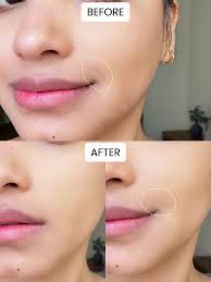 How to hide smile lines: Step-by-Step 🤍