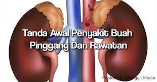 Ia banyak bergantung kepada penyebab penyakit buah pinggang tersebut serta tahap kerosakan buah pinggang itu sendiri. Tanda Tanda Awal Penyakit Buah Pinggang Dan Rawatannya Anda Mesti Tahu Ini Sebelum Terlambat Infoje Org
