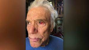 Bernard tapie, 78, and wife dominique, 70, attacked in luxury home near paris pictures show mr tapie has a bloodshot eye and the pair have severe bruising the burglars evaded security outside the. Ce Que L On Sait Du Violent Home Jacking De Bernard Tapie Et Son Epouse