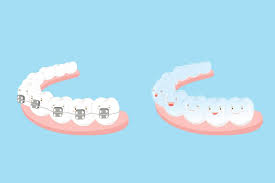 Jun 03, 2021 · while teeth grinding is often stress related in adults, physical causes—mouth irritation, allergies, or misaligned teeth—are more likely the cause in kids. What You Should Do When Considering Diy Braces