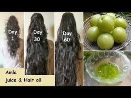 • leave overnight for best results. Amla For Hair Growth Gives Benefits Of Amla For Hair Problem