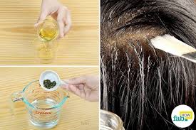 Have You Been Scratching Your Head Incessantly Has Your Black Shirt Been Plagued With White Speckles Falling From Y Dry Flaky Scalp Dry Flaky Skin Flaky Scalp