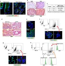 Colorectal cancer, also called colon cancer, is the second leading cause of cancer deaths in the u.s. Targeting Chemoresistant Colorectal Cancer Via Systemic Administration Of A Bmp7 Variant Oncogene