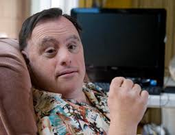 Chromosome 21?: UCI researchers studying link between Down syndrome and  Alzheimer's