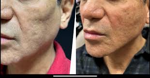 Hung William Song (@drbillsong) • Instagram photos and videos