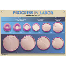 Progress In Labor Chart