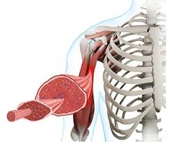 Image result for Myopathy