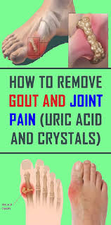 Pin On Health
