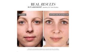 Check spelling or type a new query. Up To 74 Off On Rodan And Fields Enhancements Groupon Goods