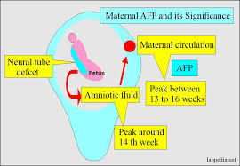 Maternal afp serum level is used to screen for down syndrome, neural tube defects, and other chromosomal abnormalities. Alpha Fetoprotein Afp A Fetoprotein And Its Significance Labpedia Net