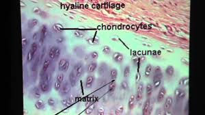Hyaline cartilage is a type of connective tissue found in areas such as the nose, ears, and похожие запросы для hyaline cartilage location in body. Hyaline Cartilage Connective Tissue Youtube