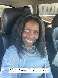 Gratifying experience with hair growth after alopecia