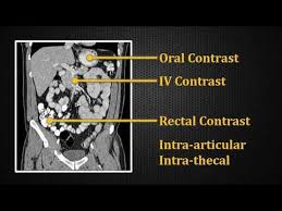 Image result for CT Intravenous Contrast