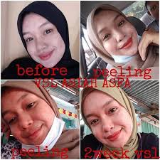 Cara penggunaan vsl skincare sis nak terangkan. Vsl Beauty Care Fatehah Segamat 2021