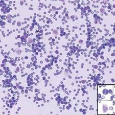 Utilice el menu de abajo para elegir la sección introducción para empezar. Pdf Leucemia Linfoblastica Aguda Em Um Cao Acute Lymphoblastic Leukemia In A Dog
