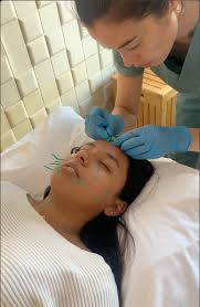 Michael Luong Acupuncture & Traditional Chinese Medicine